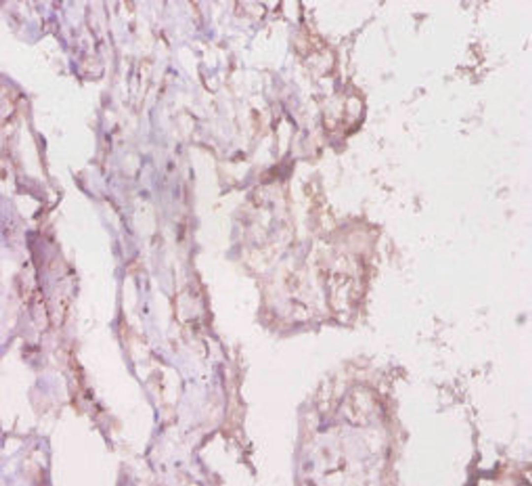 Immunohistochemistry of paraffin-embedded human placenta tissue using CSB-PA013070LA01HU at dilution of 1:20