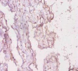 Immunohistochemistry of paraffin-embedded human placenta tissue using CSB-PA013070LA01HU at dilution of 1:20