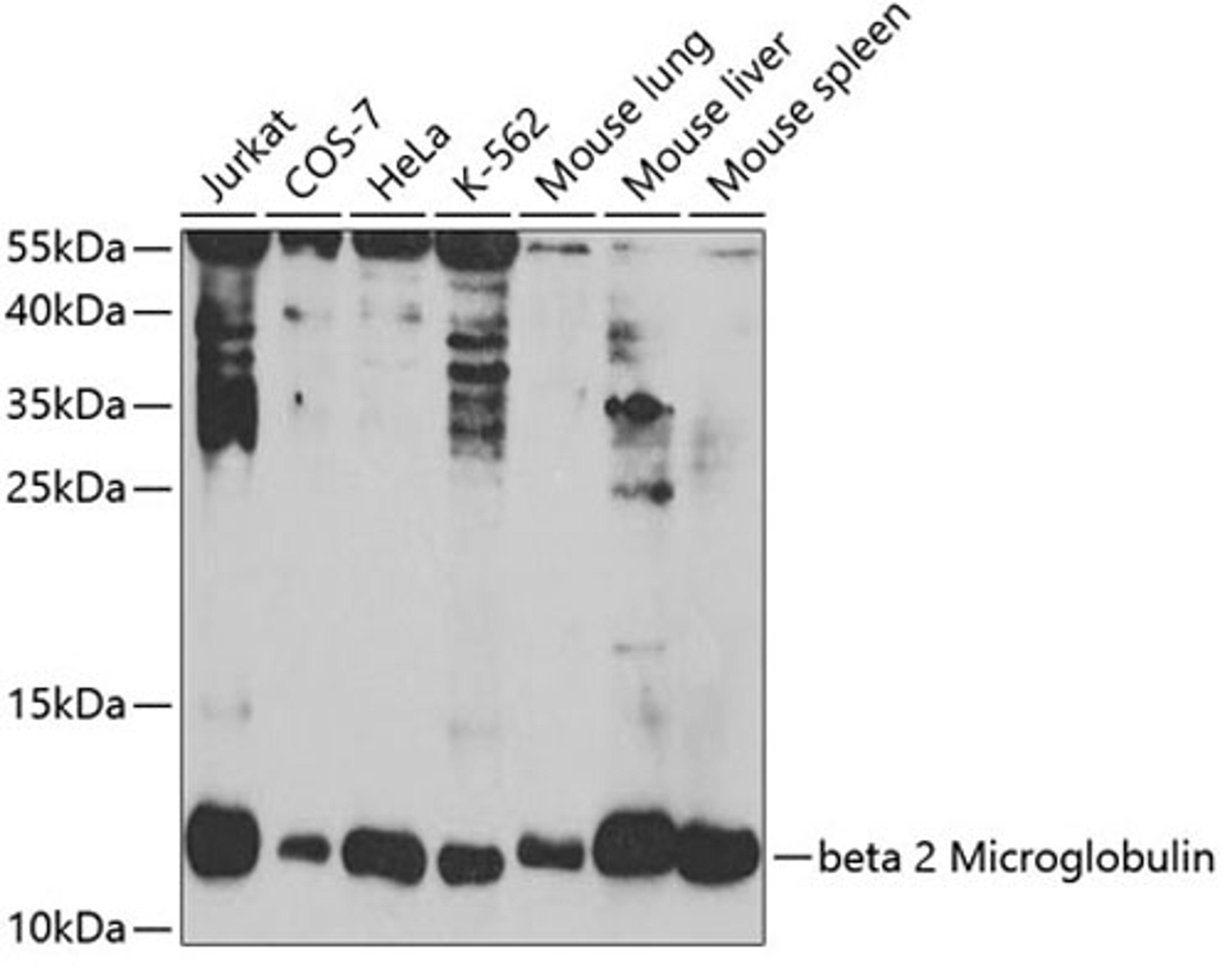 Western blot - beta 2 Microglobulin antibody (A1562)