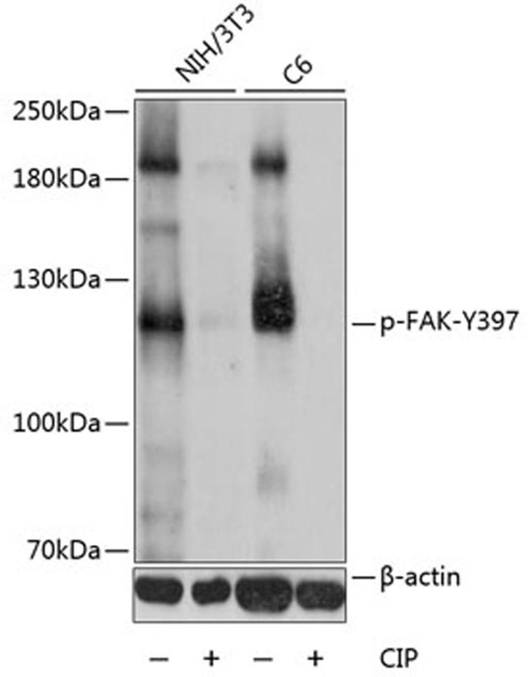 Western blot - Phospho-FAK-Y397 antibody (AP0302)