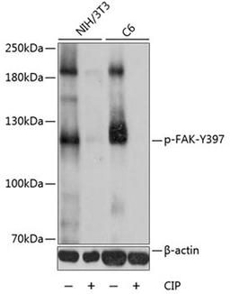 Western blot - Phospho-FAK-Y397 antibody (AP0302)