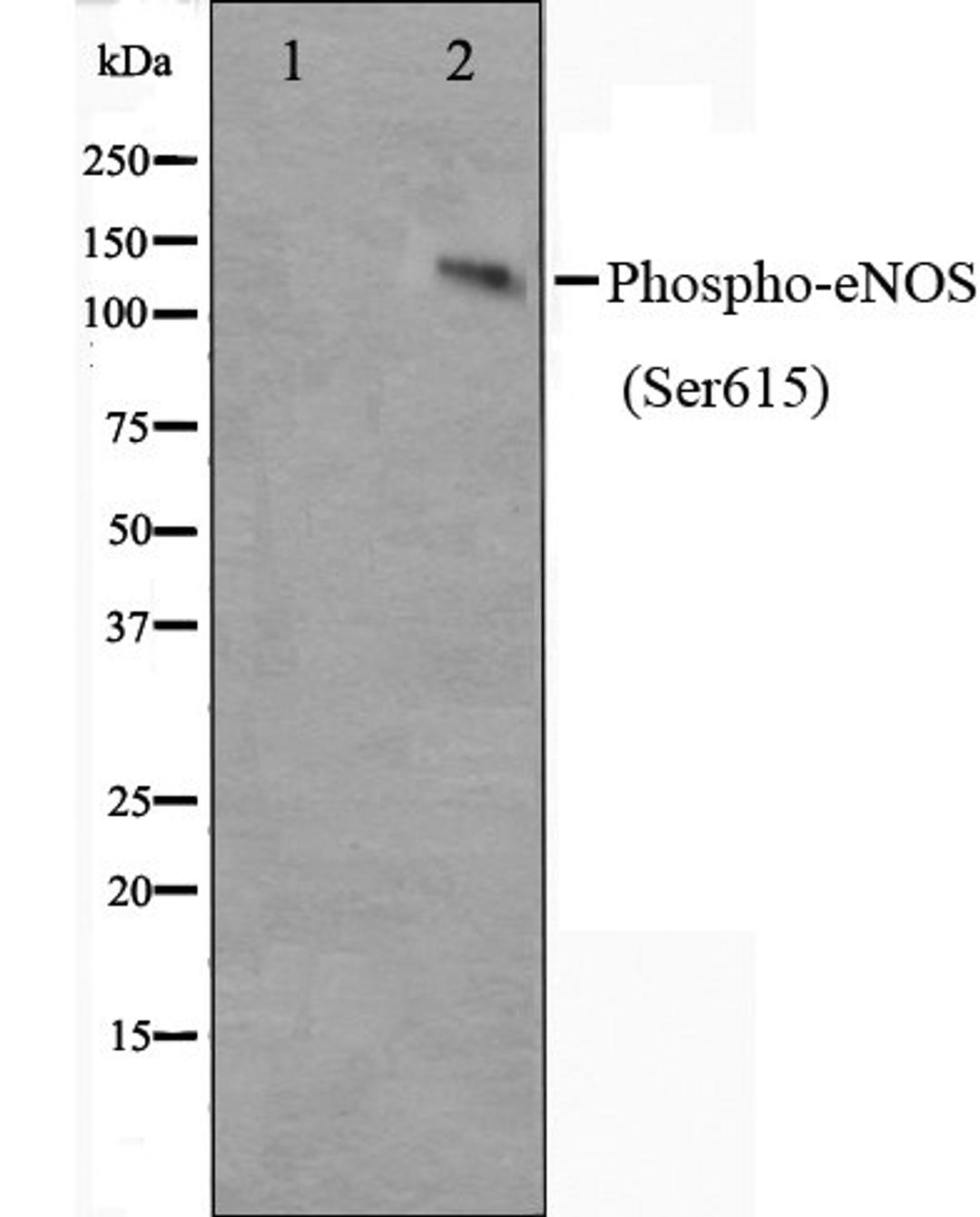 Western blot analysis of K562 cell lysate using eNOS (Phospho-Ser615) antibody