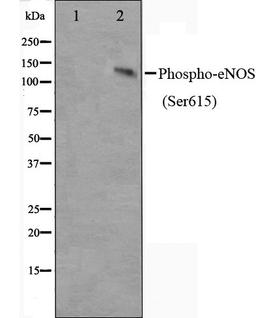 Western blot analysis of K562 cell lysate using eNOS (Phospho-Ser615) antibody