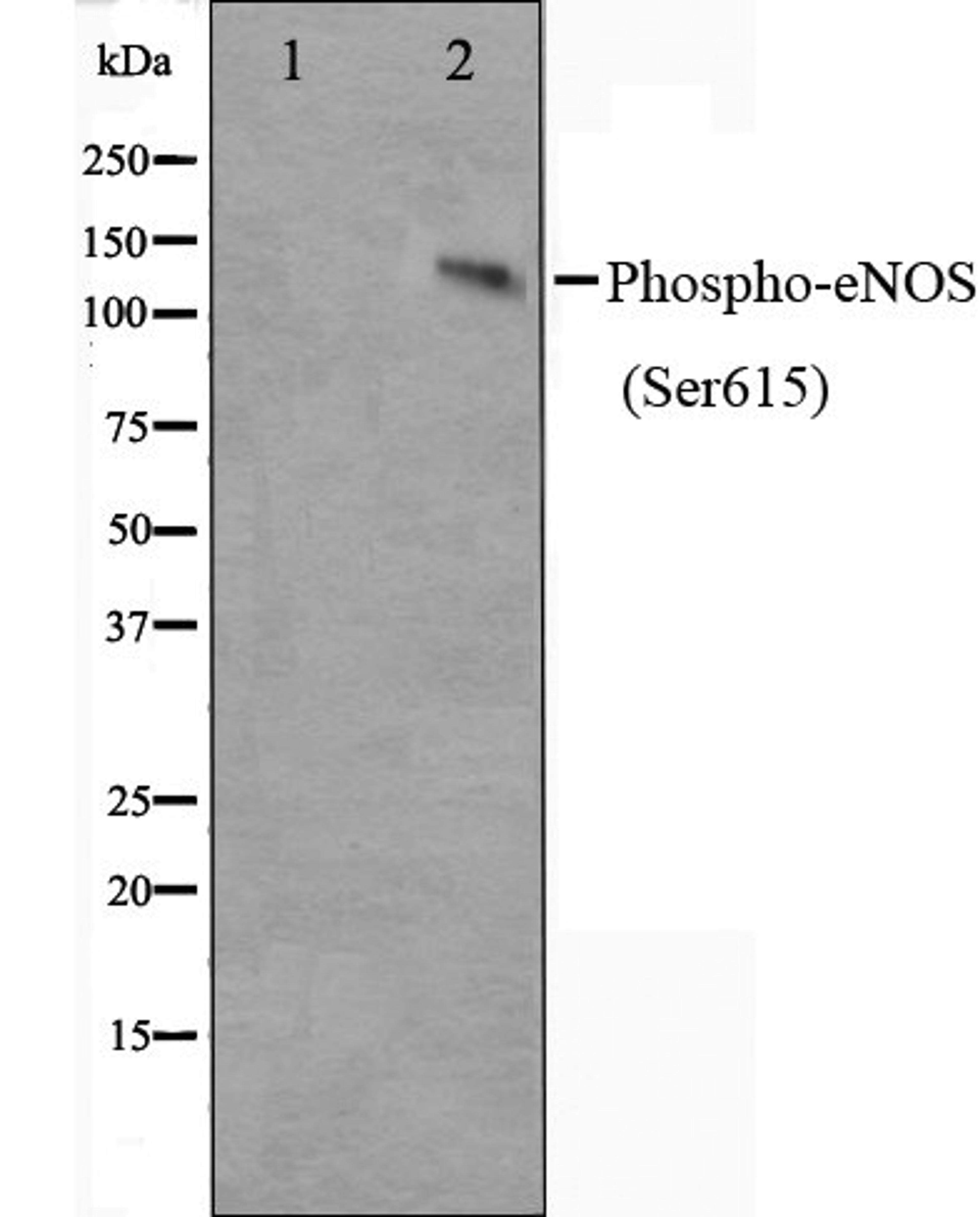 Western blot analysis of K562 cell lysate using eNOS (Phospho-Ser615) antibody