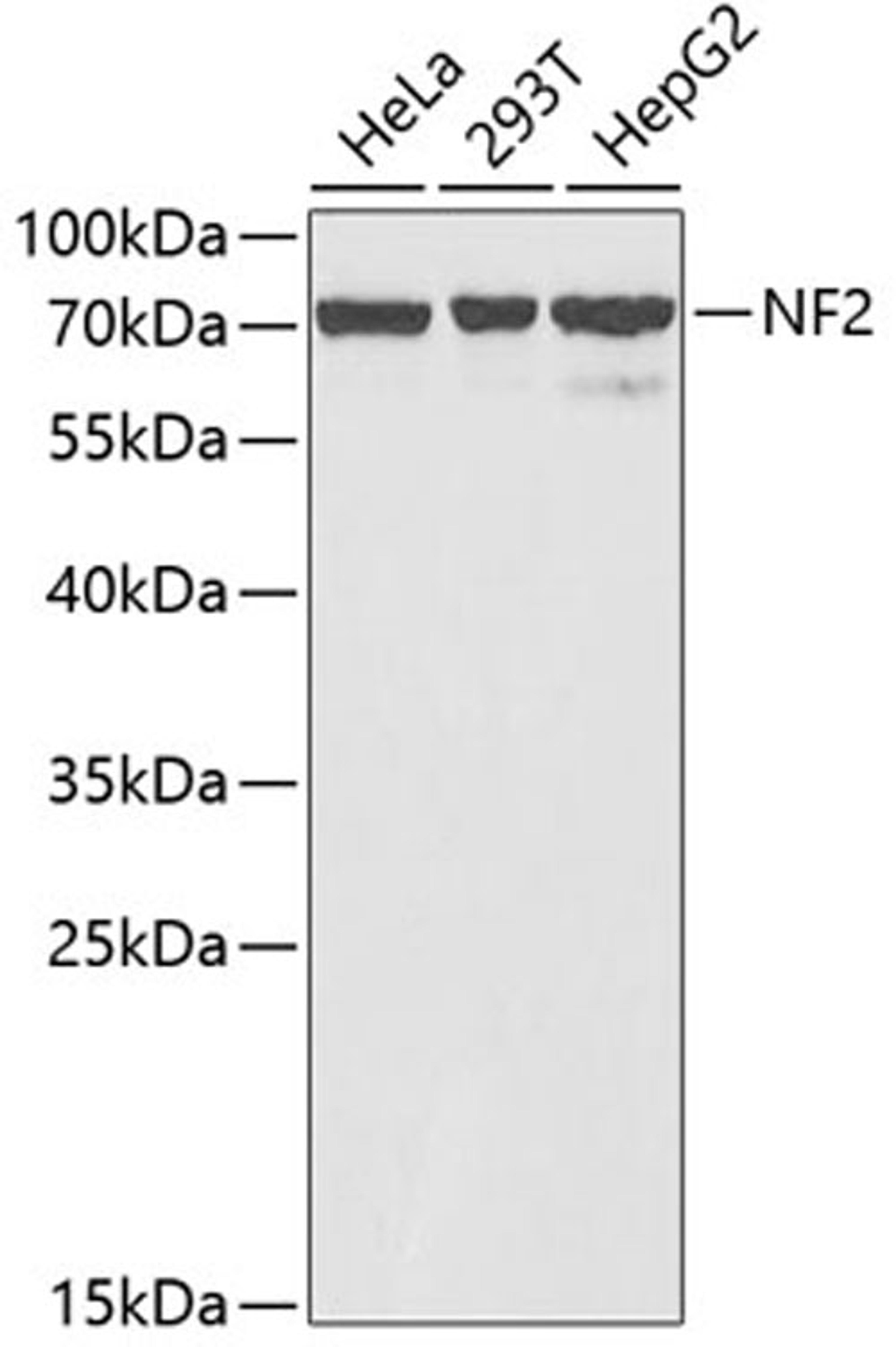 Western blot - NF2 antibody (A2456)