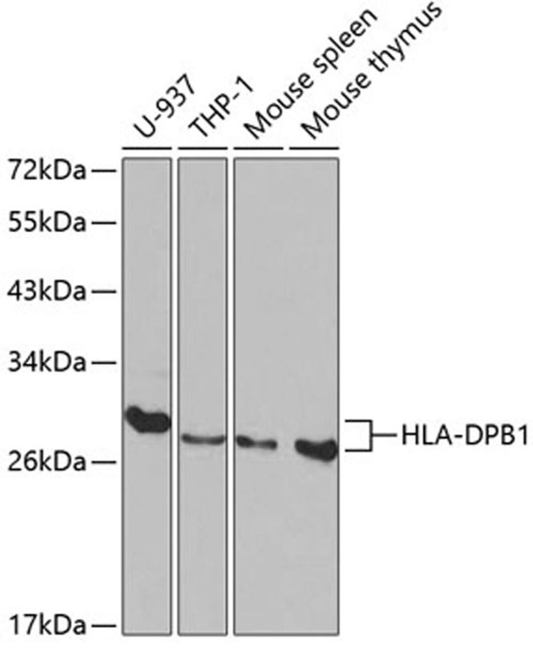 Western blot - HLA-DPB1 antibody (A1412)