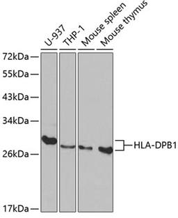 Western blot - HLA-DPB1 antibody (A1412)