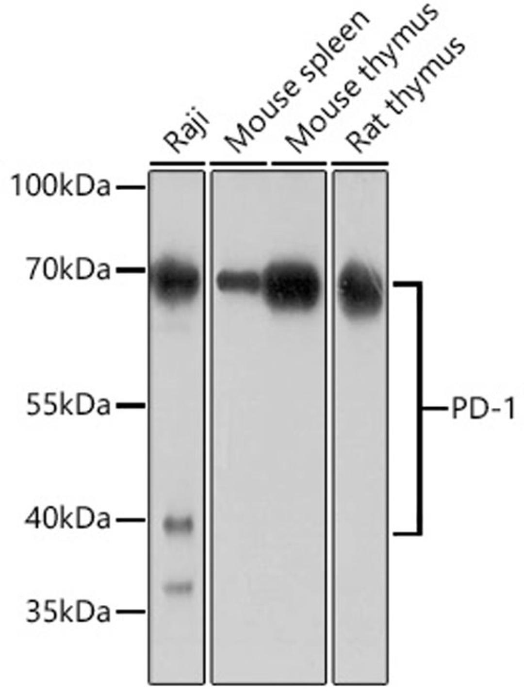 Western blot - PD-1 antibody (A11973)