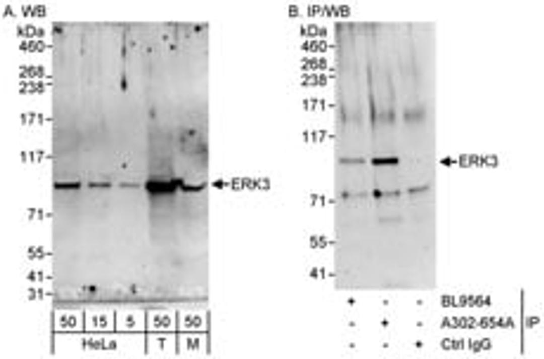 Detection of human and mouse ERK3 by western blot (h&m) and immunoprecipitation (h).