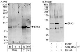 Detection of human and mouse ERK3 by western blot (h&m) and immunoprecipitation (h).