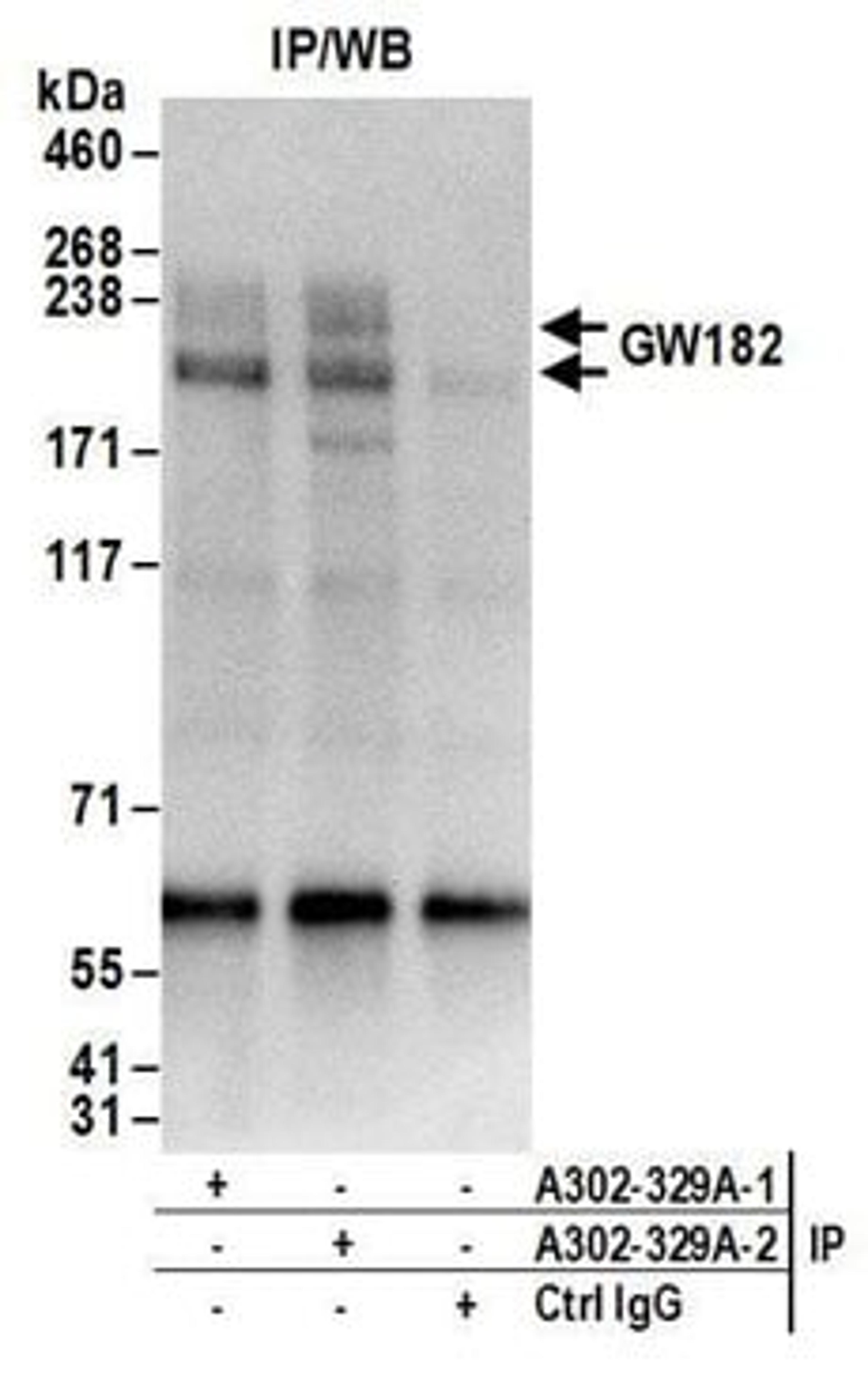 Detection of human GW182 by western blot of immunoprecipitates.