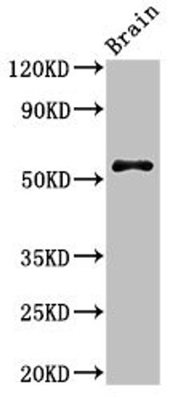 Western Blot. Positive WB detected in: Mouse brain tissue. All lanes: SRP54 antibody at 3µg/ml. Secondary. Goat polyclonal to rabbit IgG at 1/50000 dilution. Predicted band size: 56, 51 kDa. Observed band size: 56 kDa