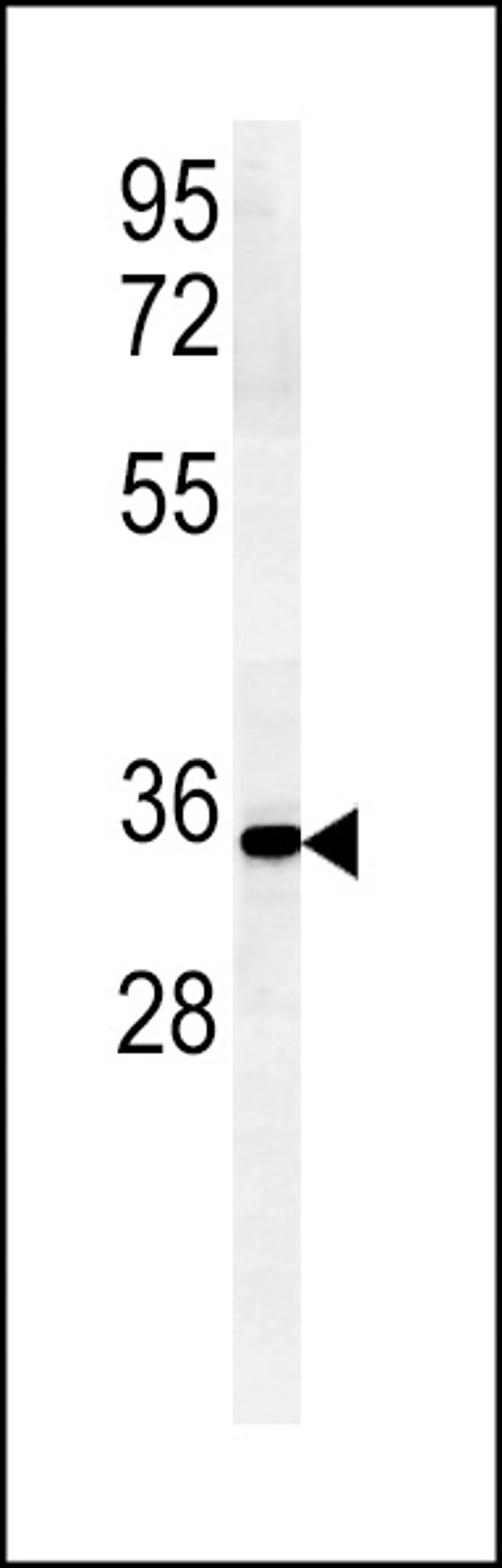 Western blot analysis in mouse Neuro-2a cell line lysates (15ug/lane).