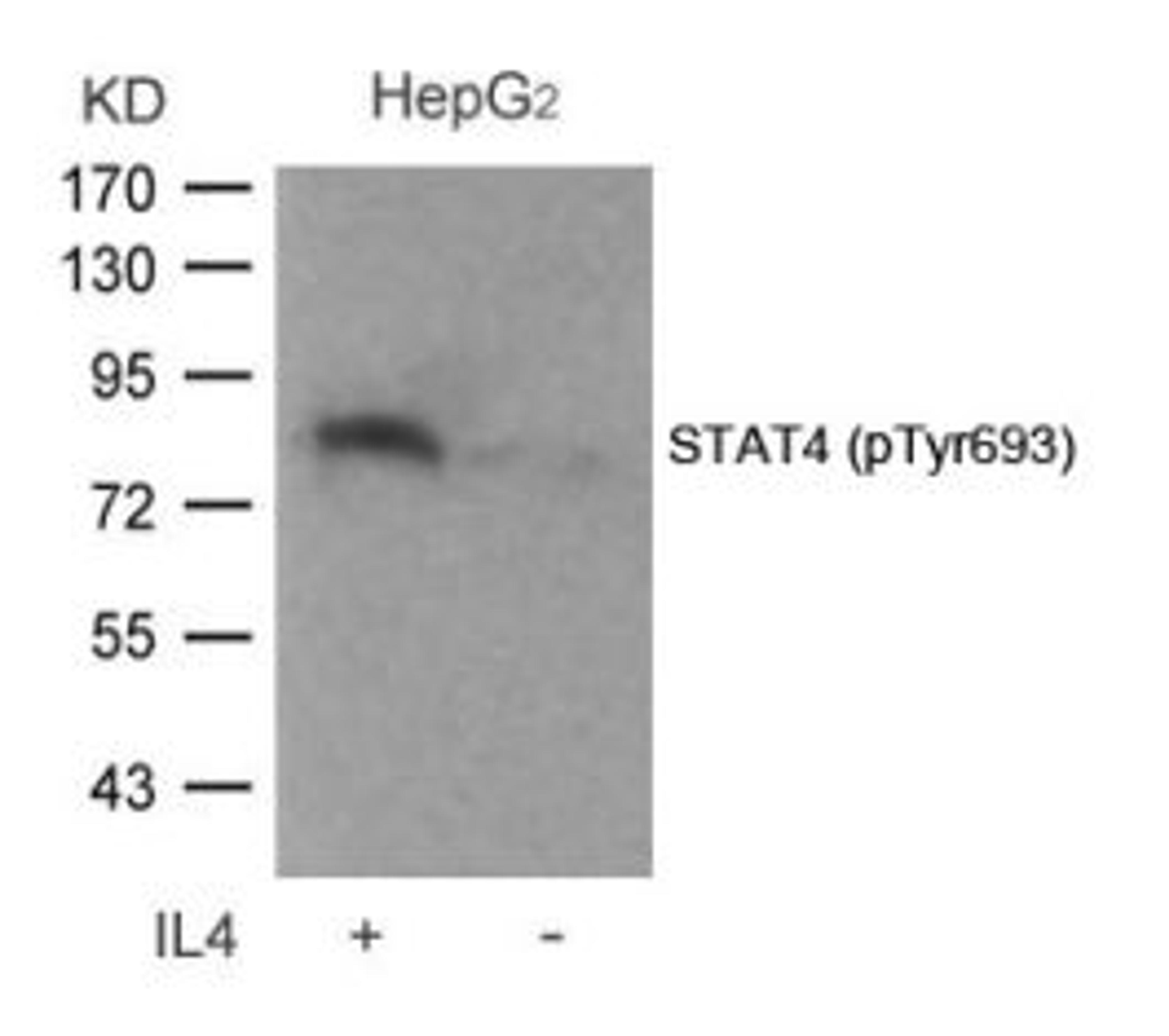 Western blot analysis of lysed extracts from HepG2 cells untreated or treated with IL-4 using STAT4 (Phospho-Tyr693).