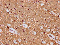 IHC image of CSB-PA862010LA01HU diluted at 1:100 and staining in paraffin-embedded human brain tissue performed on a Leica BondTM system. After dewaxing and hydration, antigen retrieval was mediated by high pressure in a citrate buffer (pH 6.0). Section was blocked with 10% normal goat serum 30min at RT. Then primary antibody (1% BSA) was incubated at 4&deg;C overnight. The primary is detected by a biotinylated secondary antibody and visualized using an HRP conjugated SP system.