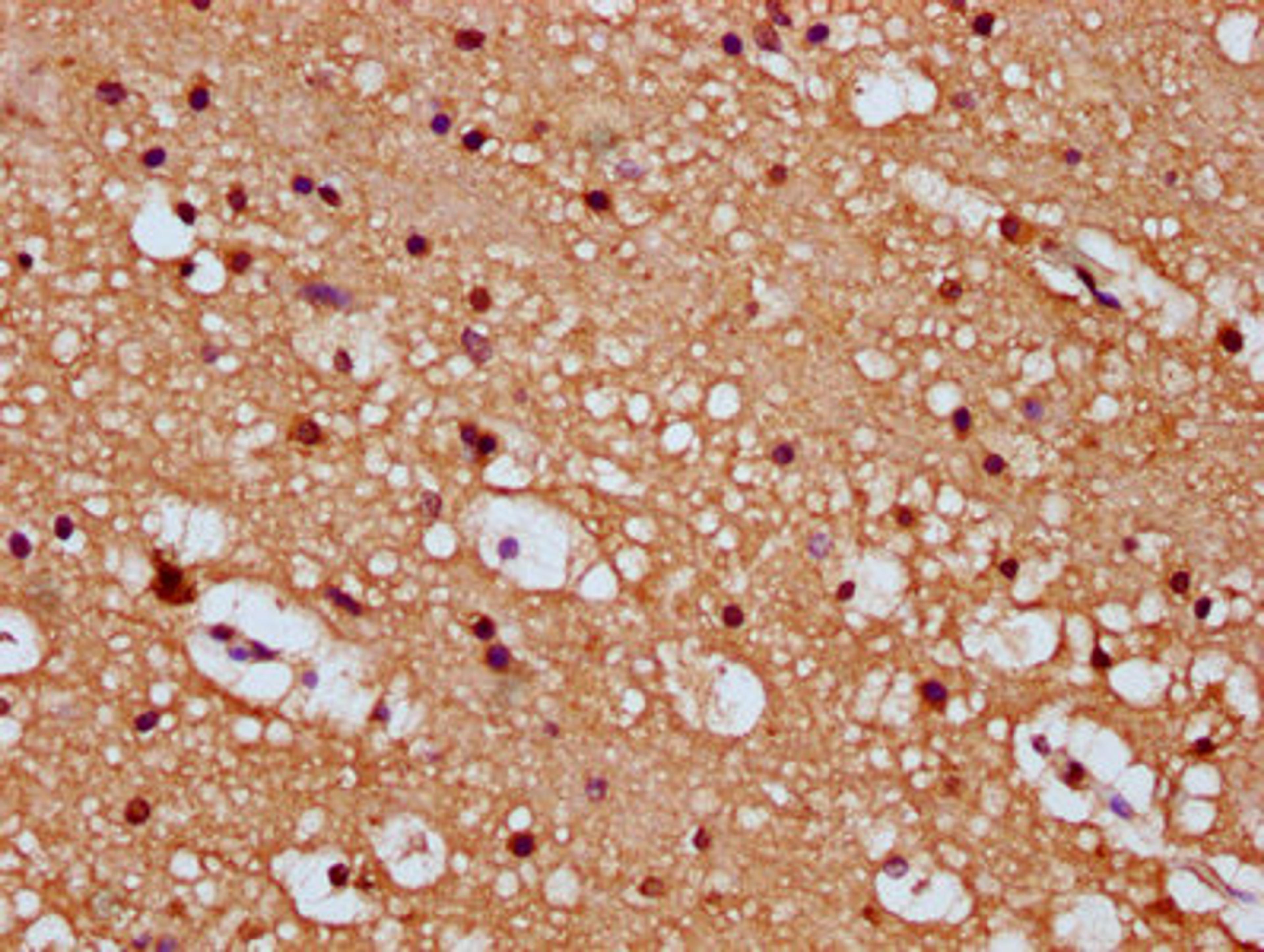 IHC image of CSB-PA862010LA01HU diluted at 1:100 and staining in paraffin-embedded human brain tissue performed on a Leica BondTM system. After dewaxing and hydration, antigen retrieval was mediated by high pressure in a citrate buffer (pH 6.0). Section was blocked with 10% normal goat serum 30min at RT. Then primary antibody (1% BSA) was incubated at 4&deg;C overnight. The primary is detected by a biotinylated secondary antibody and visualized using an HRP conjugated SP system.