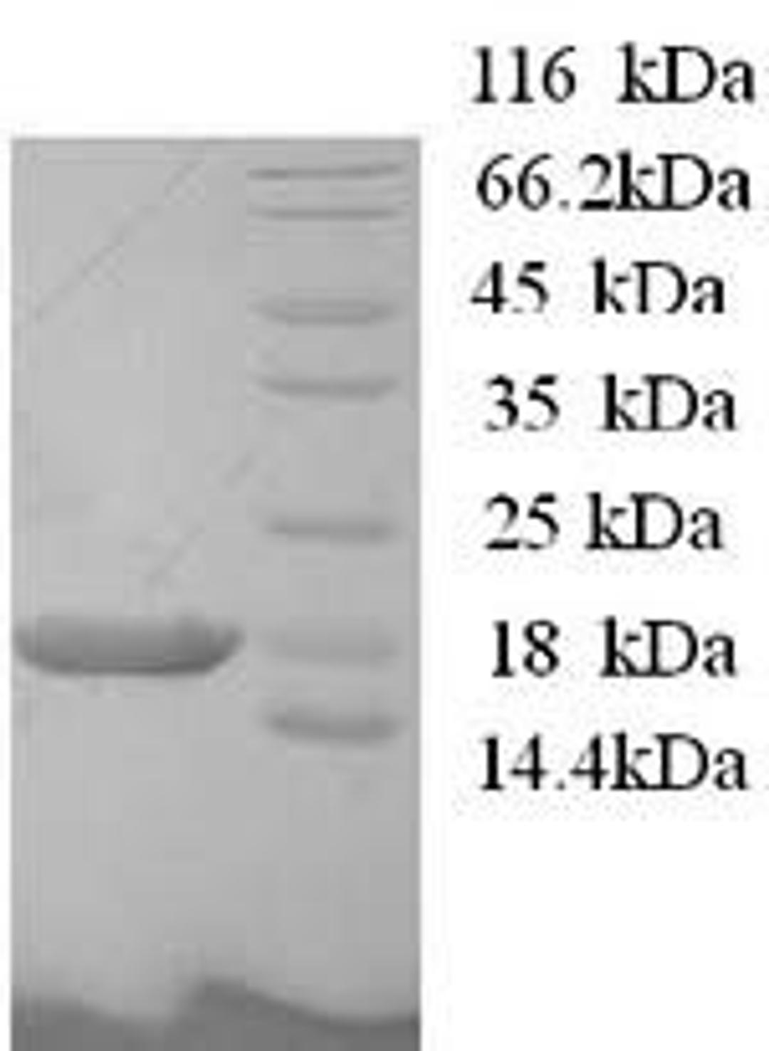 (Tris-Glycine gel) Discontinuous SDS-PAGE (reduced) with 5% enrichment gel and 15% separation gel.