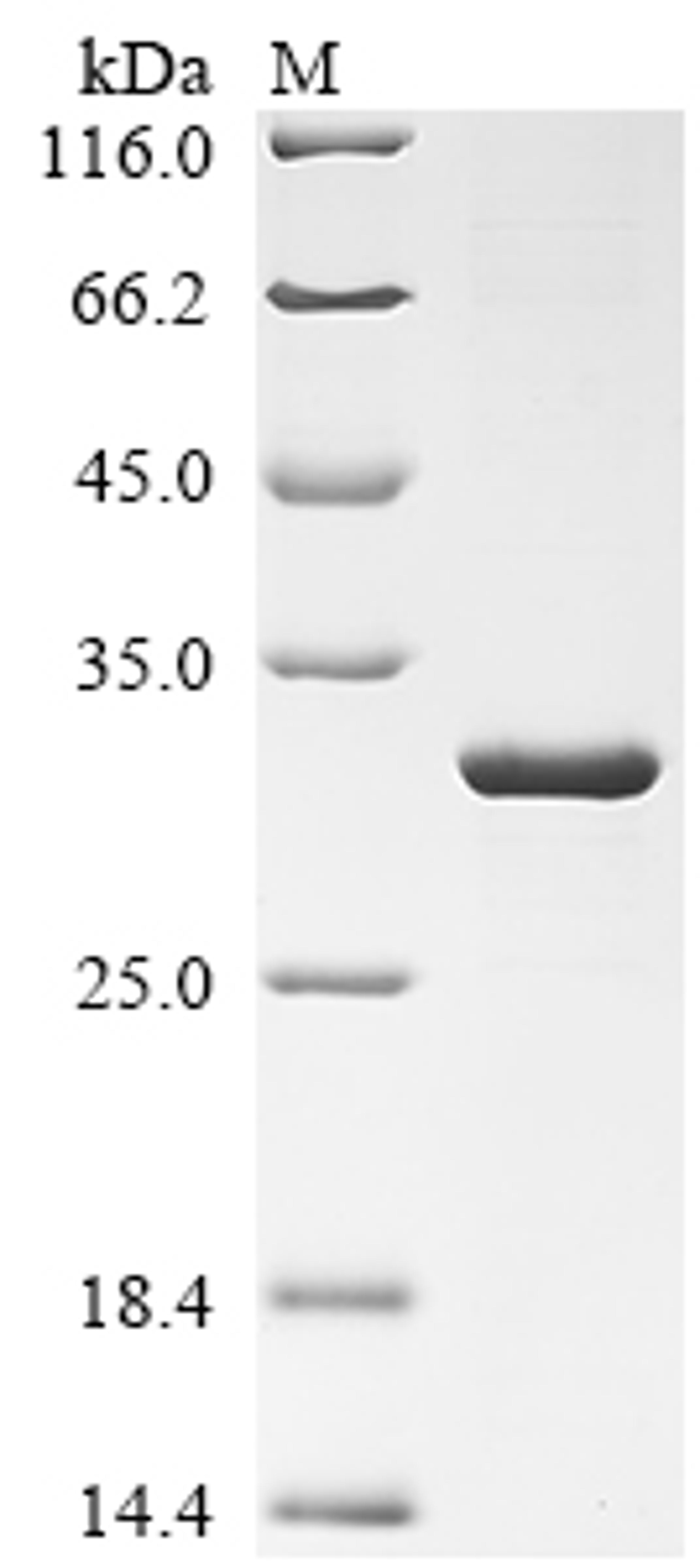 (Tris-Glycine gel) Discontinuous SDS-PAGE (reduced) with 5% enrichment gel and 15% separation gel.