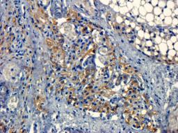 Immunohistochemical staining of paraffin embedded mouse lymph node tissue using RANK antibody (primary antibody at 1:50)