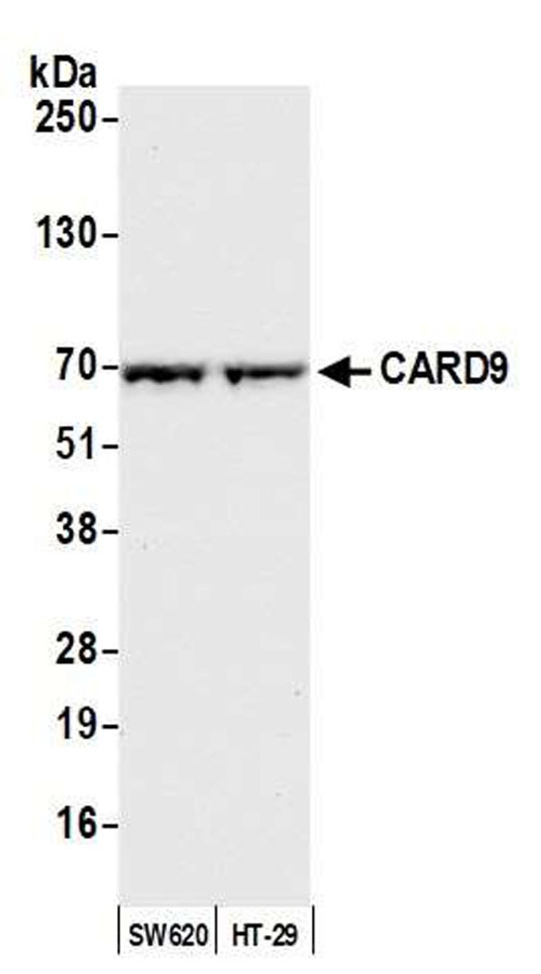 Detection of human CARD9 by WB.