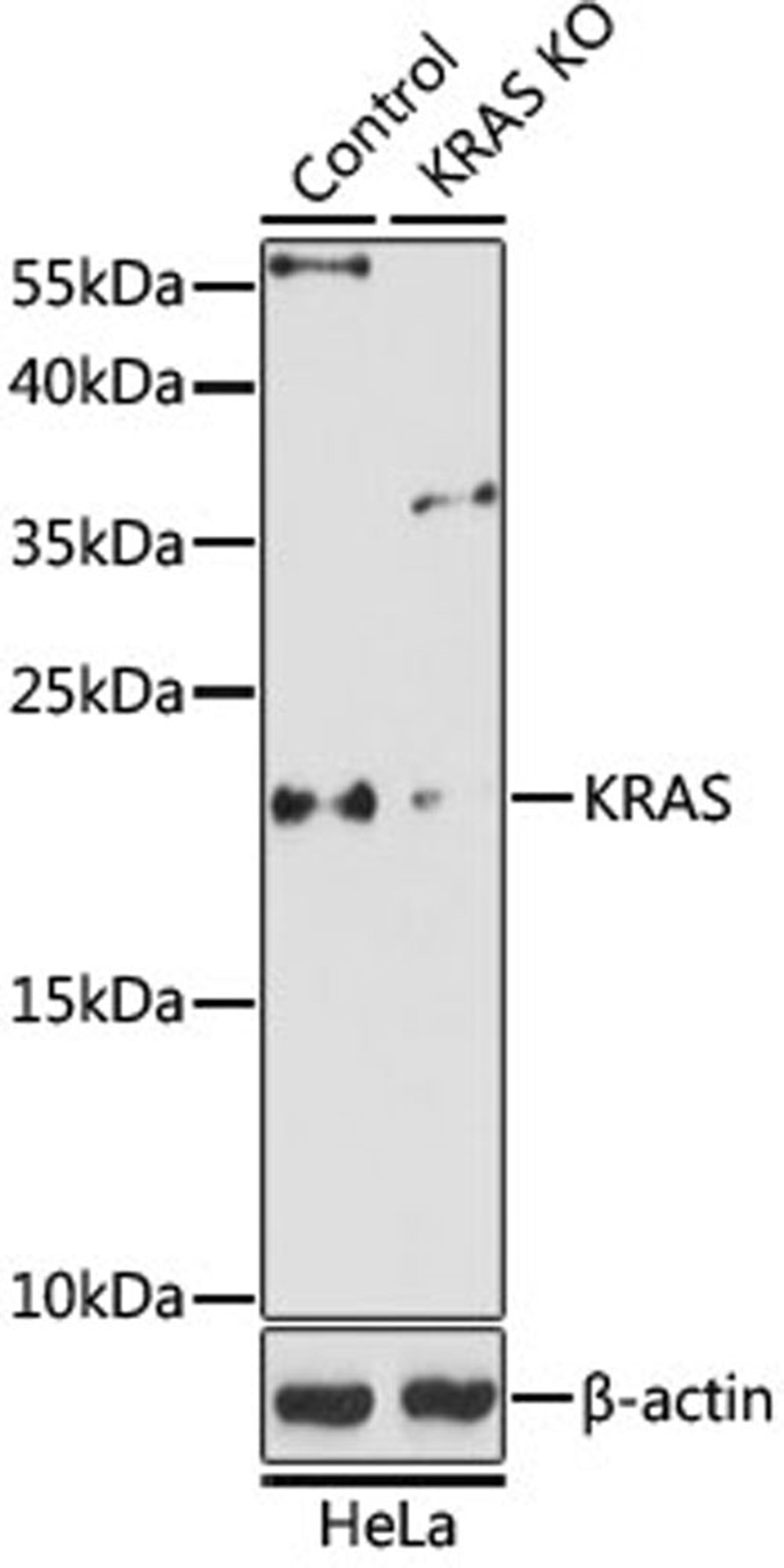 Western blot - KRAS antibody (A12704)