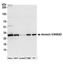 Detection of human and mouse Annexin V/ANXA5 by western blot.
