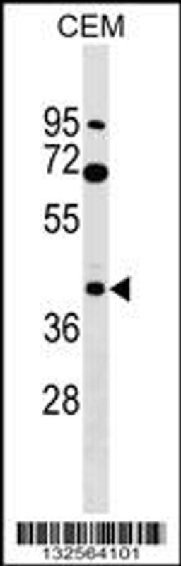 Western blot analysis in CEM cell line lysates (35ug/lane).