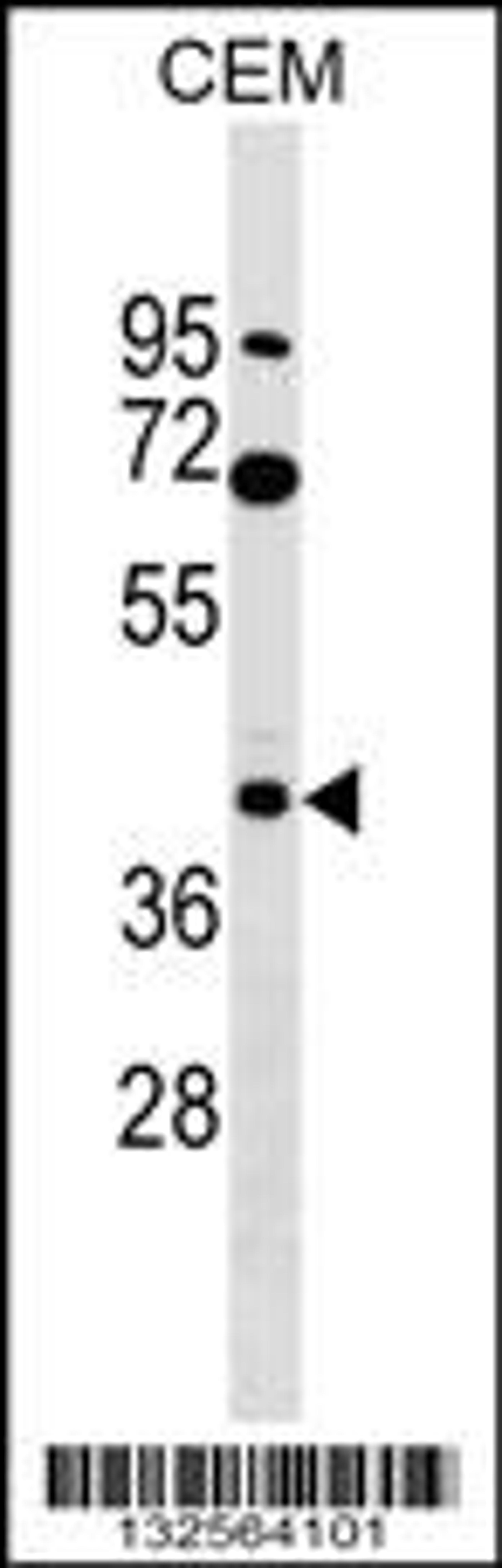 Western blot analysis in CEM cell line lysates (35ug/lane).