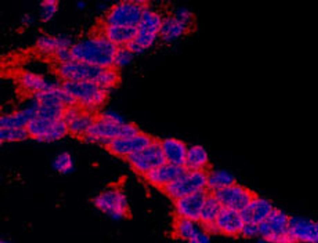 Detection of human CASC3 by immunohistochemistry.