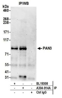 Detection of human PAN3 by western blot of immunoprecipitates.