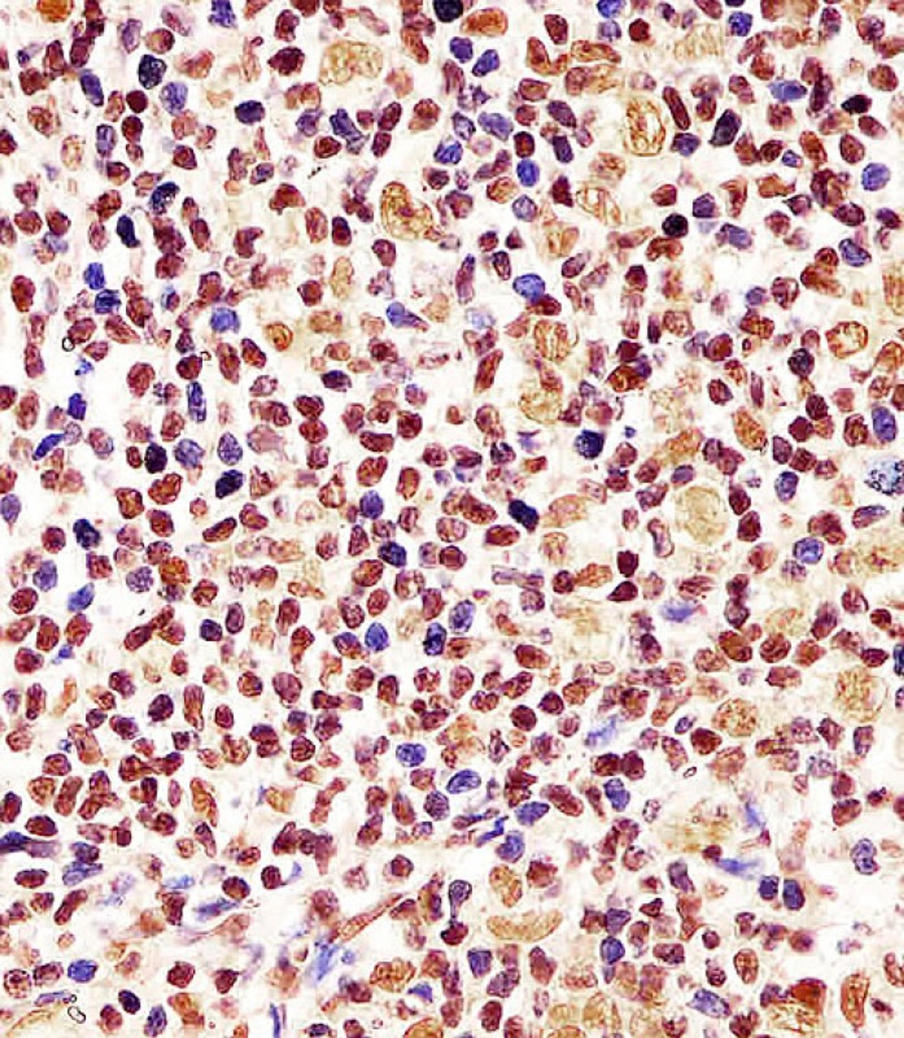 Antibody staining Cyclin D1 in human tonsil tissue sections by Immunohistochemistry (IHC-P - paraformaldehyde-fixed, paraffin-embedded sections).