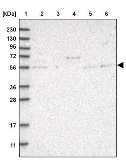 Western Blot: AGPAT7 Antibody [NBP1-90210] - Lane 1: Marker [kDa] 230, 130, 95, 72, 56, 36, 28, 17, 11<br/>Lane 2: Human cell line RT-4<br/>Lane 3: Human cell line U-251MG sp<br/>Lane 4: Human plasma (IgG/HSA depleted)<br/>Lane 5: Human liver tissue<br/>Lane 6: Human tonsil tissue