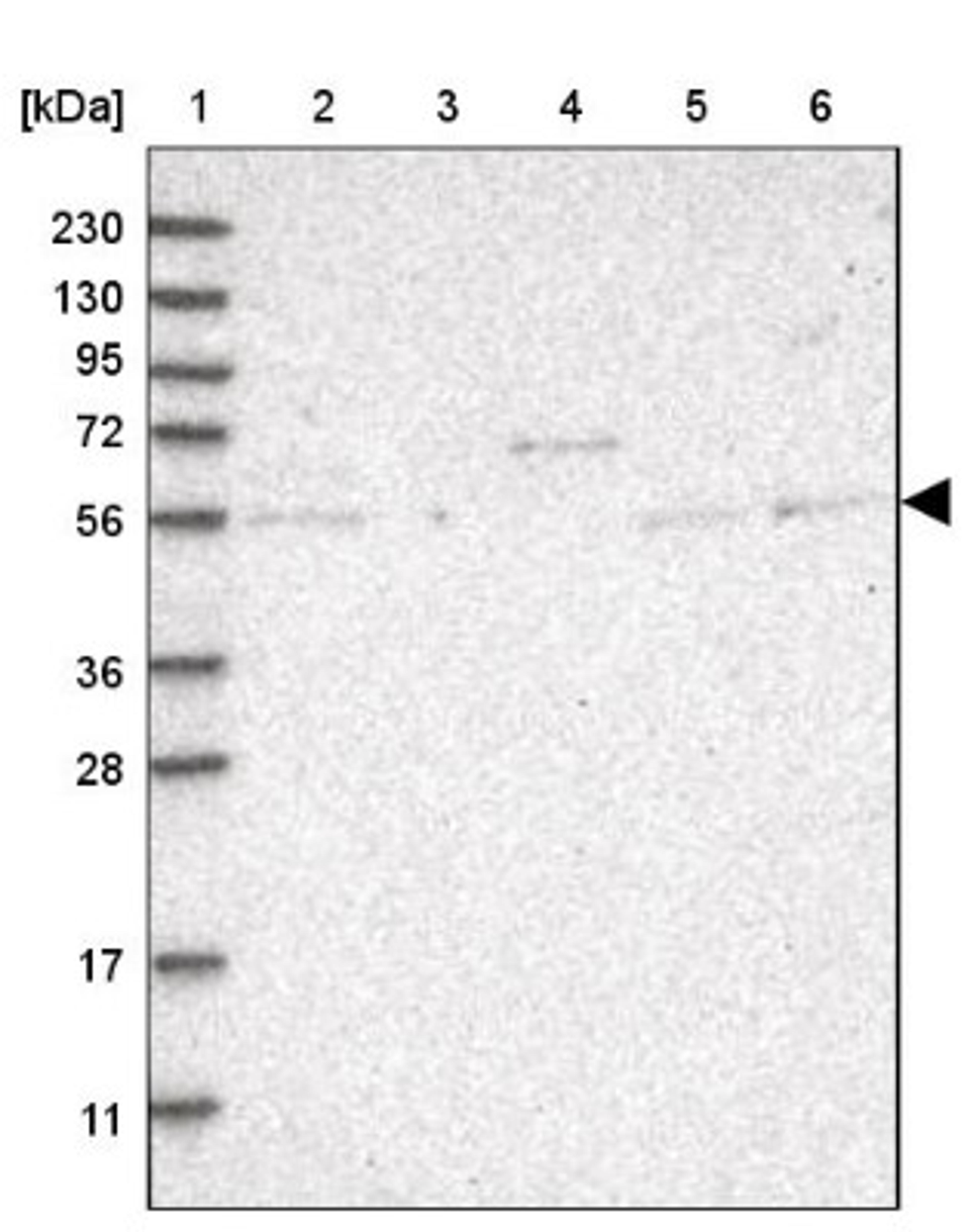 Western Blot: AGPAT7 Antibody [NBP1-90210] - Lane 1: Marker [kDa] 230, 130, 95, 72, 56, 36, 28, 17, 11<br/>Lane 2: Human cell line RT-4<br/>Lane 3: Human cell line U-251MG sp<br/>Lane 4: Human plasma (IgG/HSA depleted)<br/>Lane 5: Human liver tissue<br/>Lane 6: Human tonsil tissue