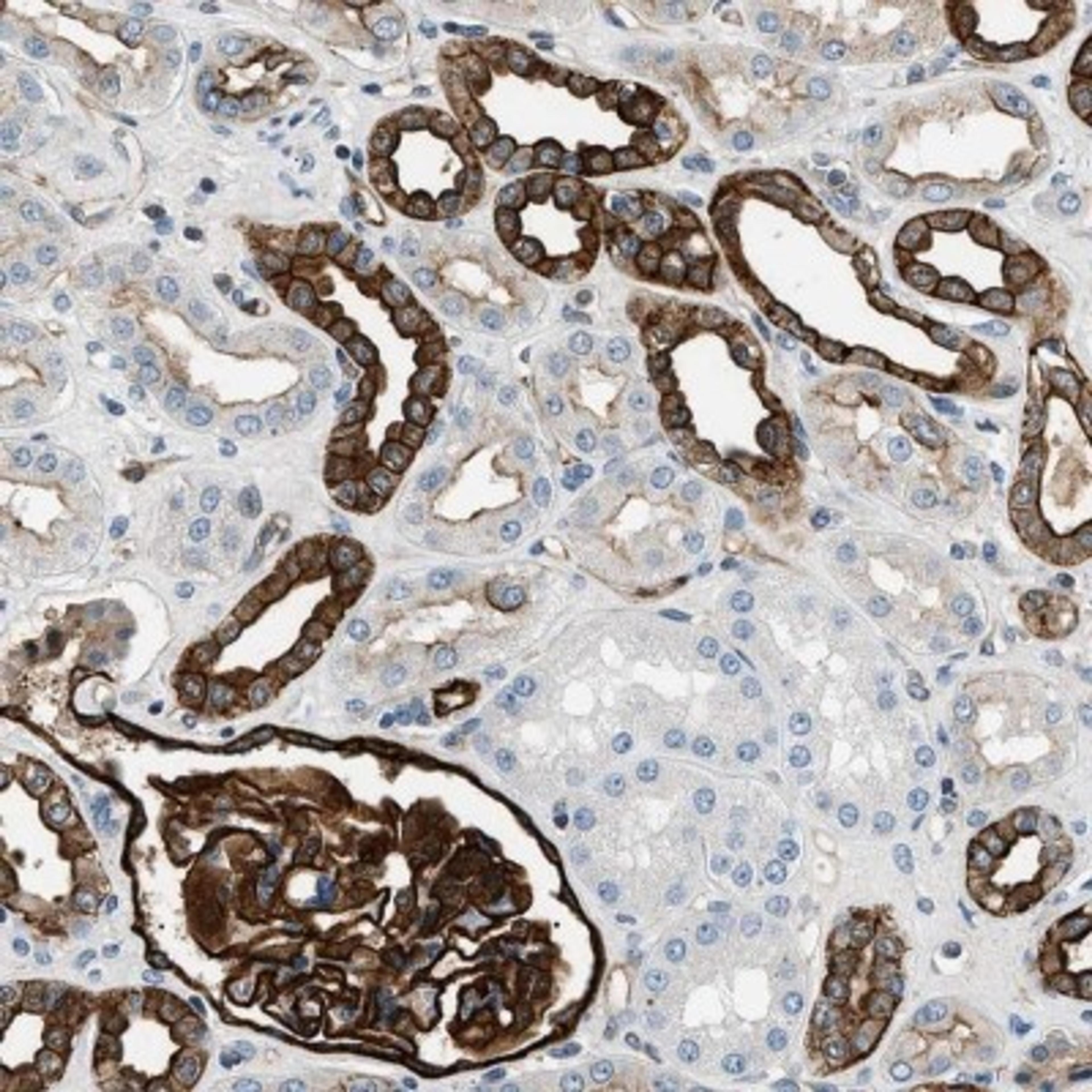 Immunohistochemistry: AIF1L Antibody [NBP2-32004] - Staining of human kidney shows strong membranous and cytoplasmic positivity in kidney tubules and glomeruli.