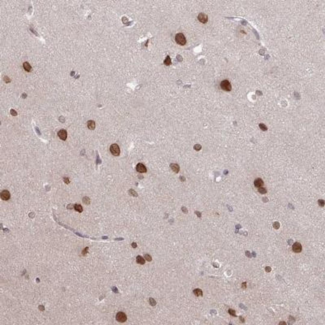 Immunohistochemistry: RBM4 Antibody [NBP2-46671] - Analysis  of human cerebral cortex shows strong nuclear and nuclear membrane positivity in neuronal cells.