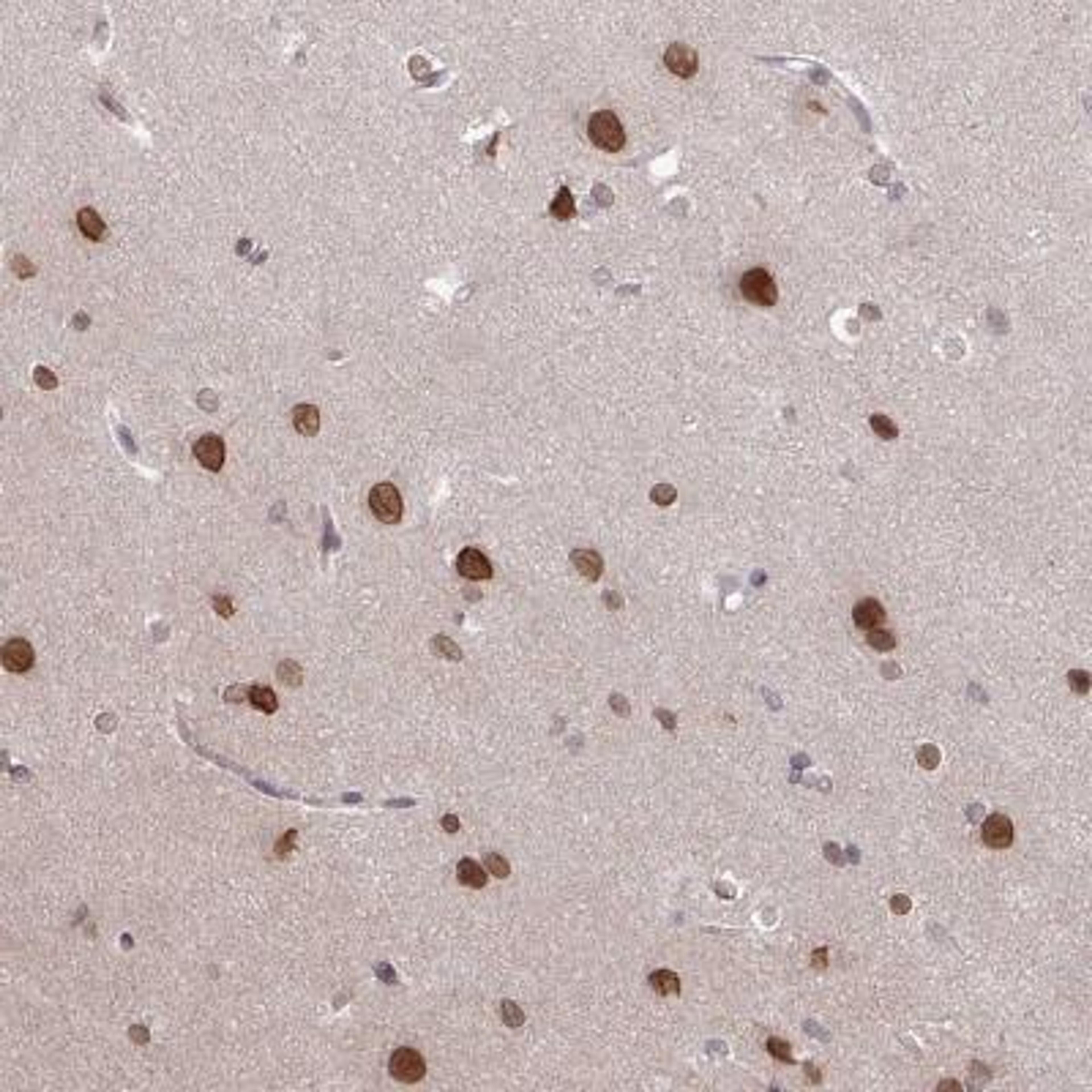 Immunohistochemistry: RBM4 Antibody [NBP2-46671] - Analysis  of human cerebral cortex shows strong nuclear and nuclear membrane positivity in neuronal cells.