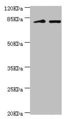 Western blot. All lanes: KIF2B antibody at 3.59ug/ml. Lane 1: Mouse lung tissue. Lane 2: 293T whole cell lysate. Secondary. Goat polyclonal to rabbit IgG at 1/10000 dilution. Predicted band size: 76 kDa. Observed band size: 80, 150 kDa.