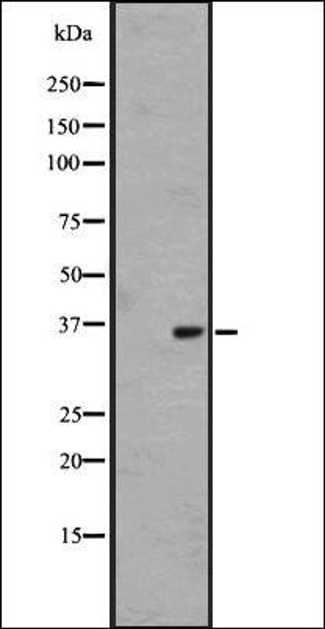 Western blot analysis of Hela cell lysate using OR1L4/1L6 antibody