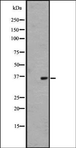 Western blot analysis of Hela cell lysate using OR1L4/1L6 antibody