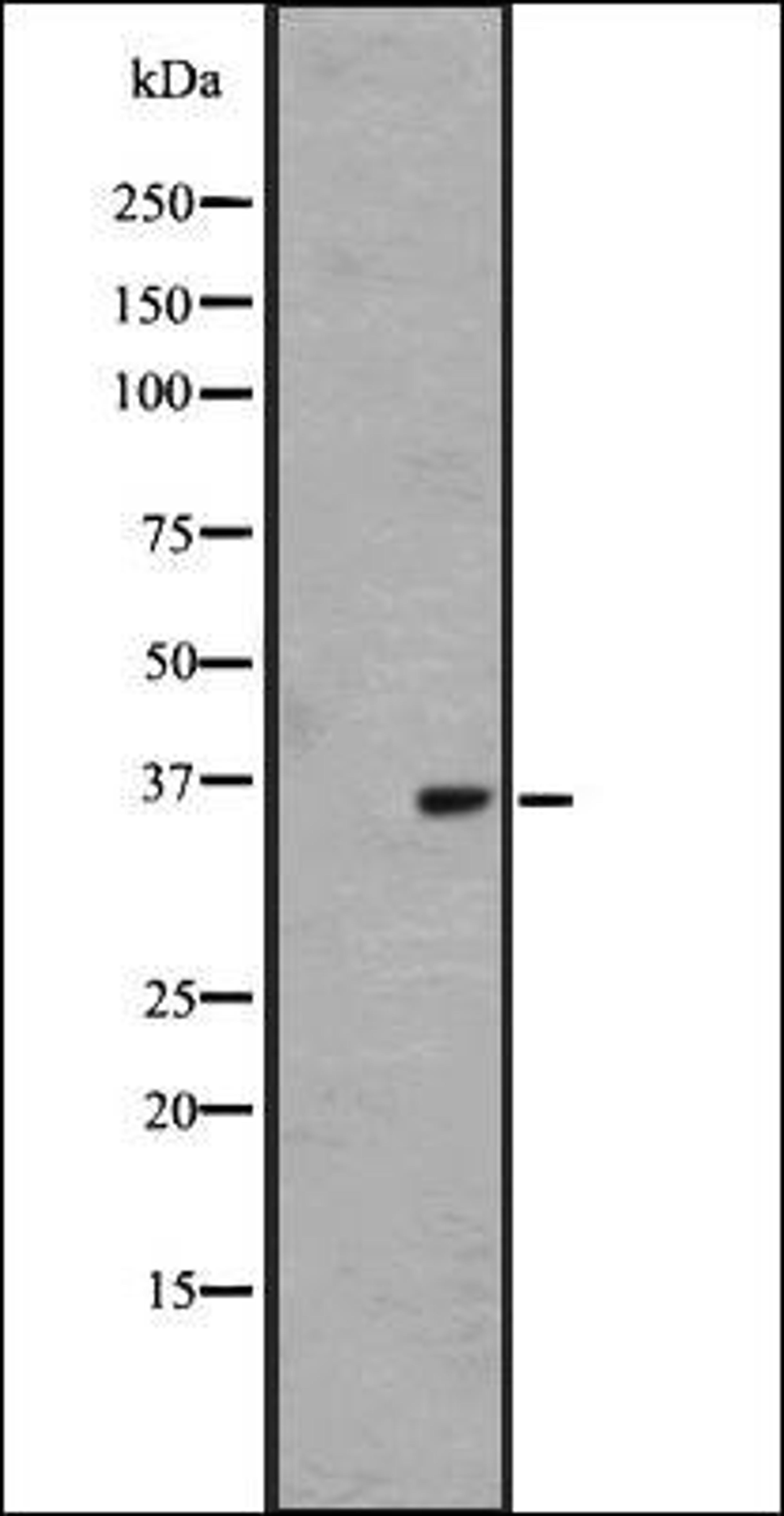 Western blot analysis of Hela cell lysate using OR1L4/1L6 antibody