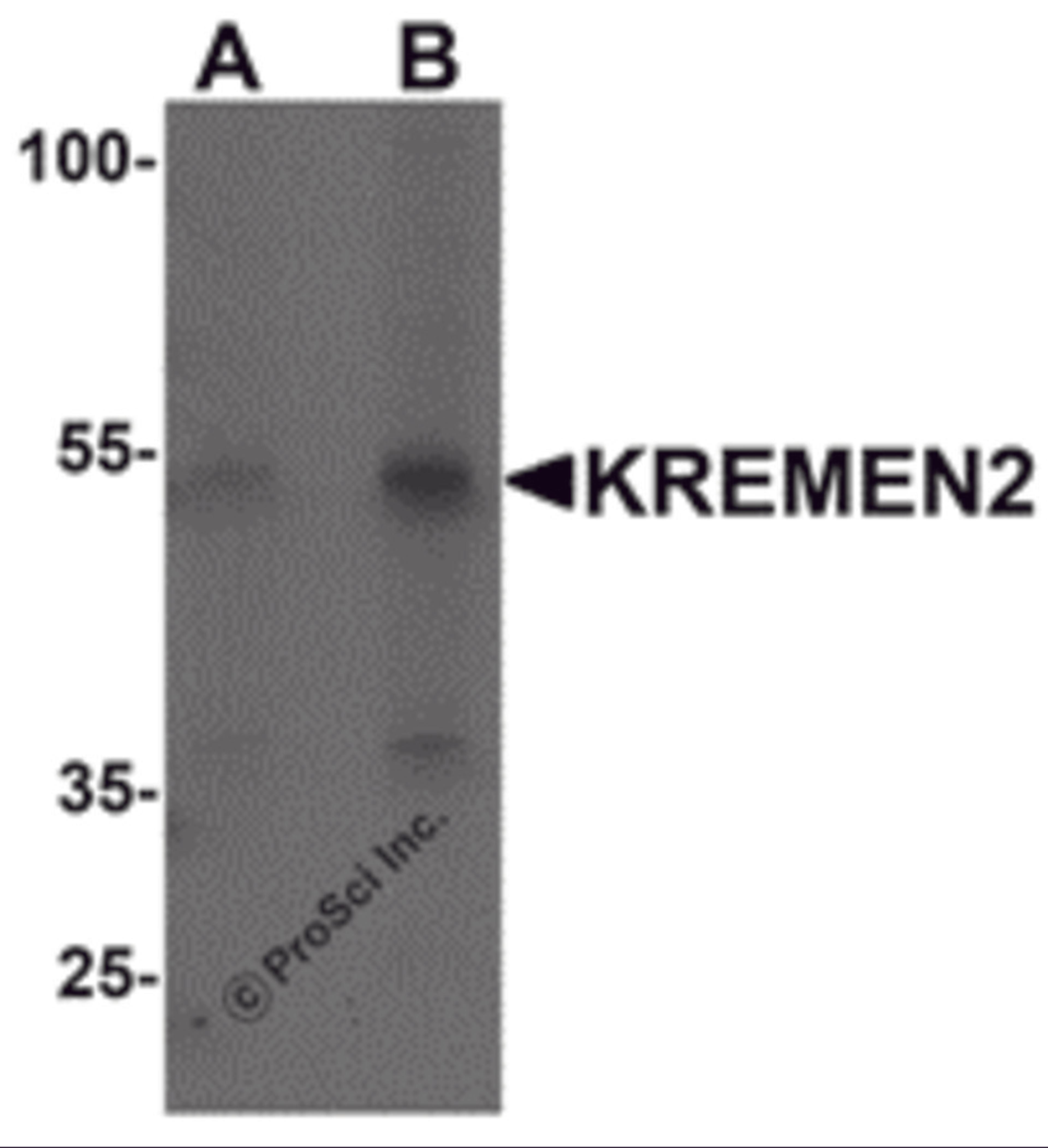 Western blot analysis of KREMEN2 in HeLa cell lysate with KREMEN2 antibody at (A) 1 and (B) 2 &#956;g/mL.