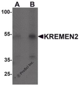 Western blot analysis of KREMEN2 in HeLa cell lysate with KREMEN2 antibody at (A) 1 and (B) 2 μg/mL.
