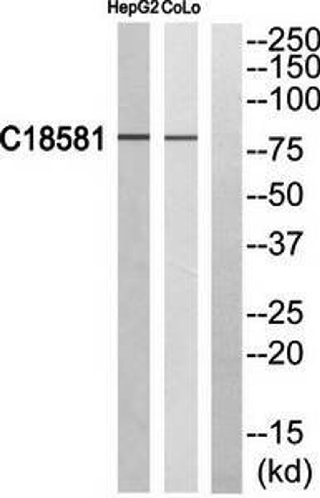 Western blot analysis of extracts from HepG2 cells and COLO205 cells using NEK5 antibody