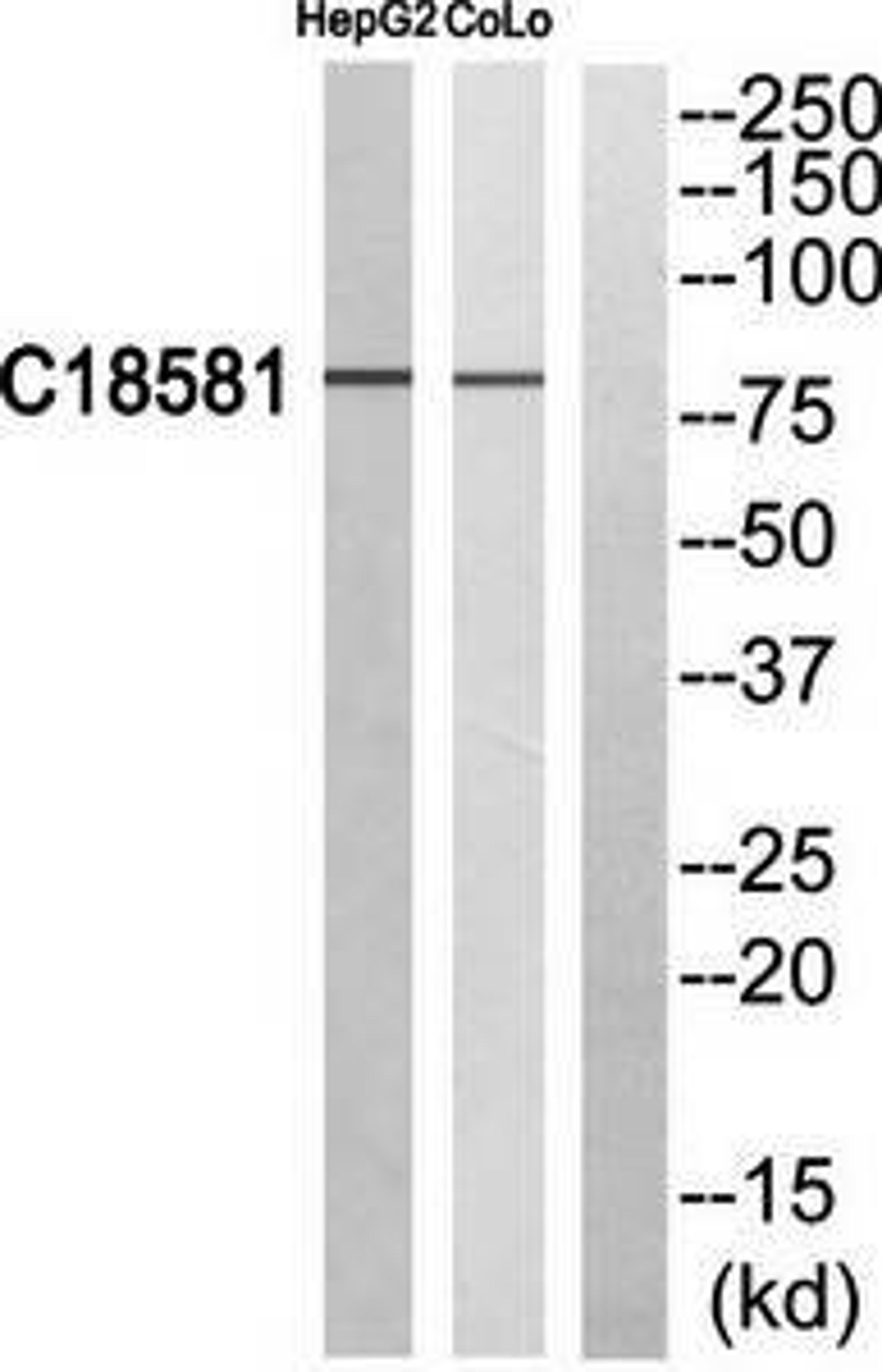 Western blot analysis of extracts from HepG2 cells and COLO205 cells using NEK5 antibody