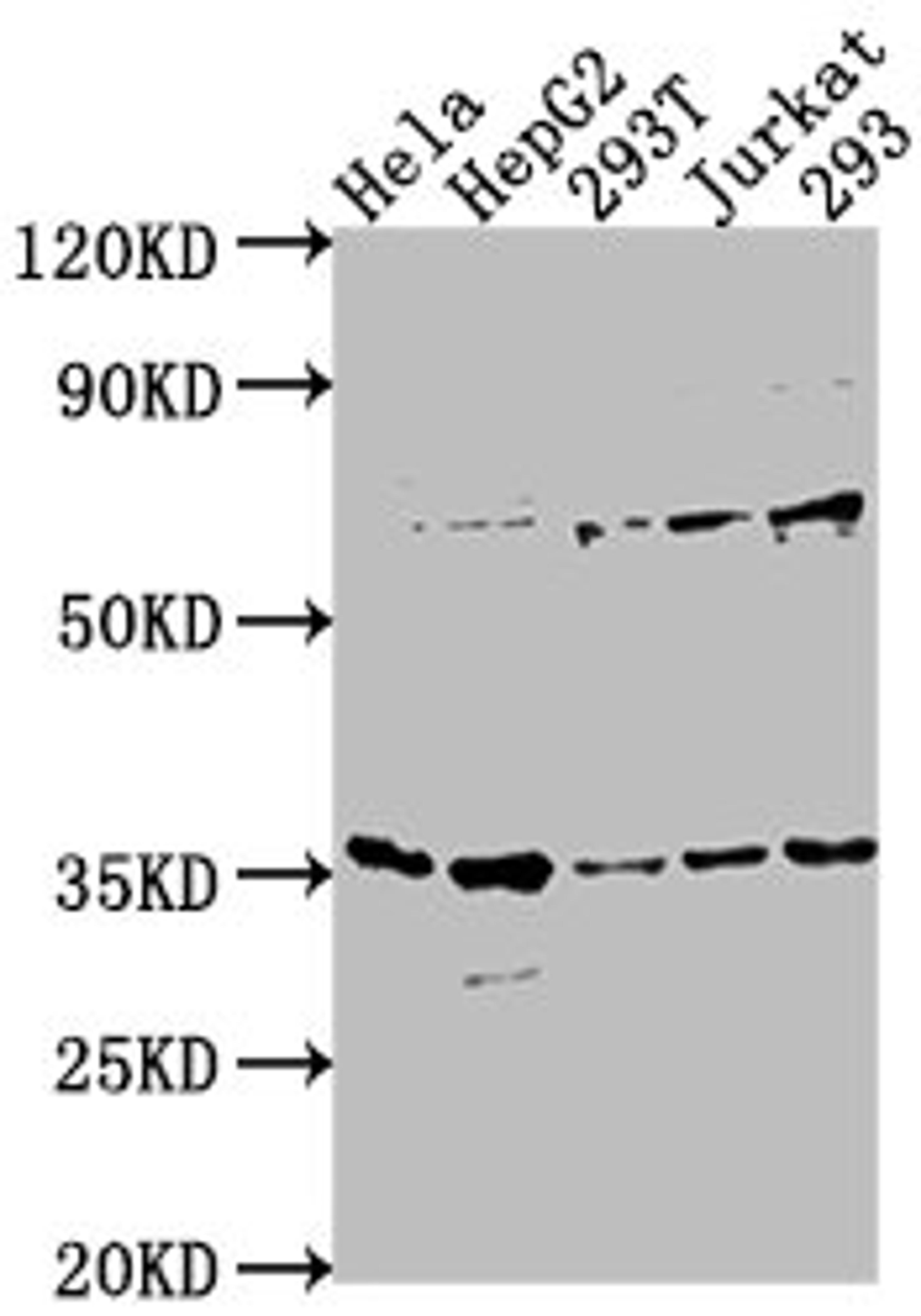 Western Blot. Positive WB detected in: Hela whole cell lysate, HepG2 whole cell lysate, 293T whole cell lysate, Jurkat whole cell lysate, 293 whole cell lysate. All lanes: MFF antibody at 1:1000. Secondary. Goat polyclonal to rabbit IgG at 1/50000 dilution. Predicted band size: 39, 33 28, 26 kDa. Observed band size: 35 kDa. 