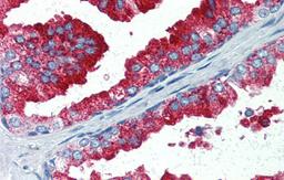 Antibody used in IHC on Human Prostate at 5.0 ug/ml.