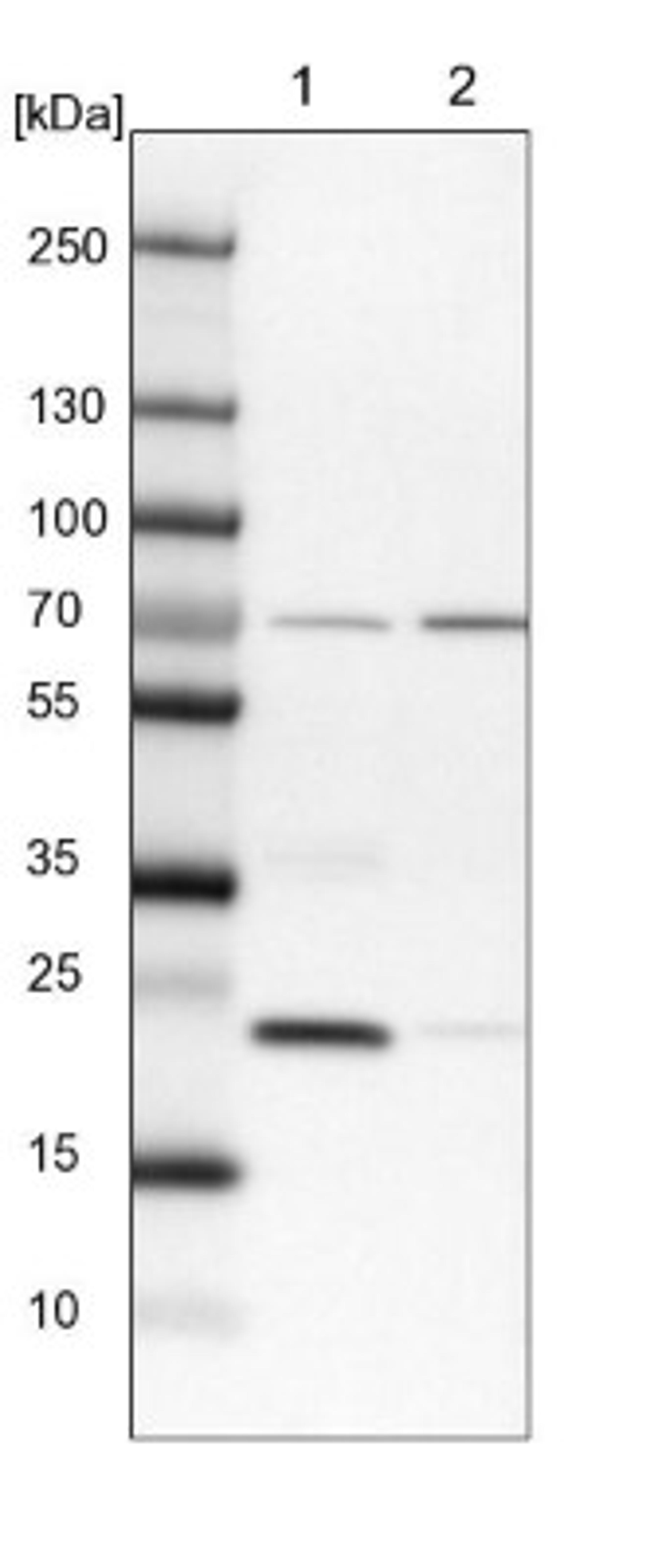 Western Blot: KLHDC10 Antibody [NBP1-81528] - Lane 1: NIH-3T3 cell lysate (Mouse embryonic fibroblast cells)<br/>Lane 2: NBT-II cell lysate (Rat Wistar bladder tumour cells)