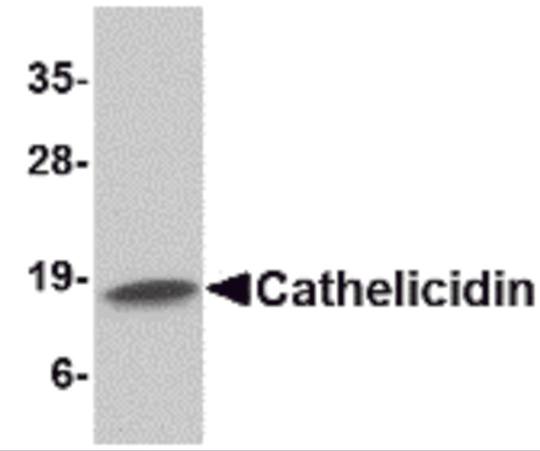 Western blot analysis of Cathelicidin in Human spleen tissue lysate with Cathelicidin antibody at 1 μg/mL.