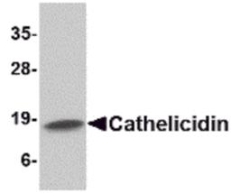 Western blot analysis of Cathelicidin in Human spleen tissue lysate with Cathelicidin antibody at 1 μg/mL.