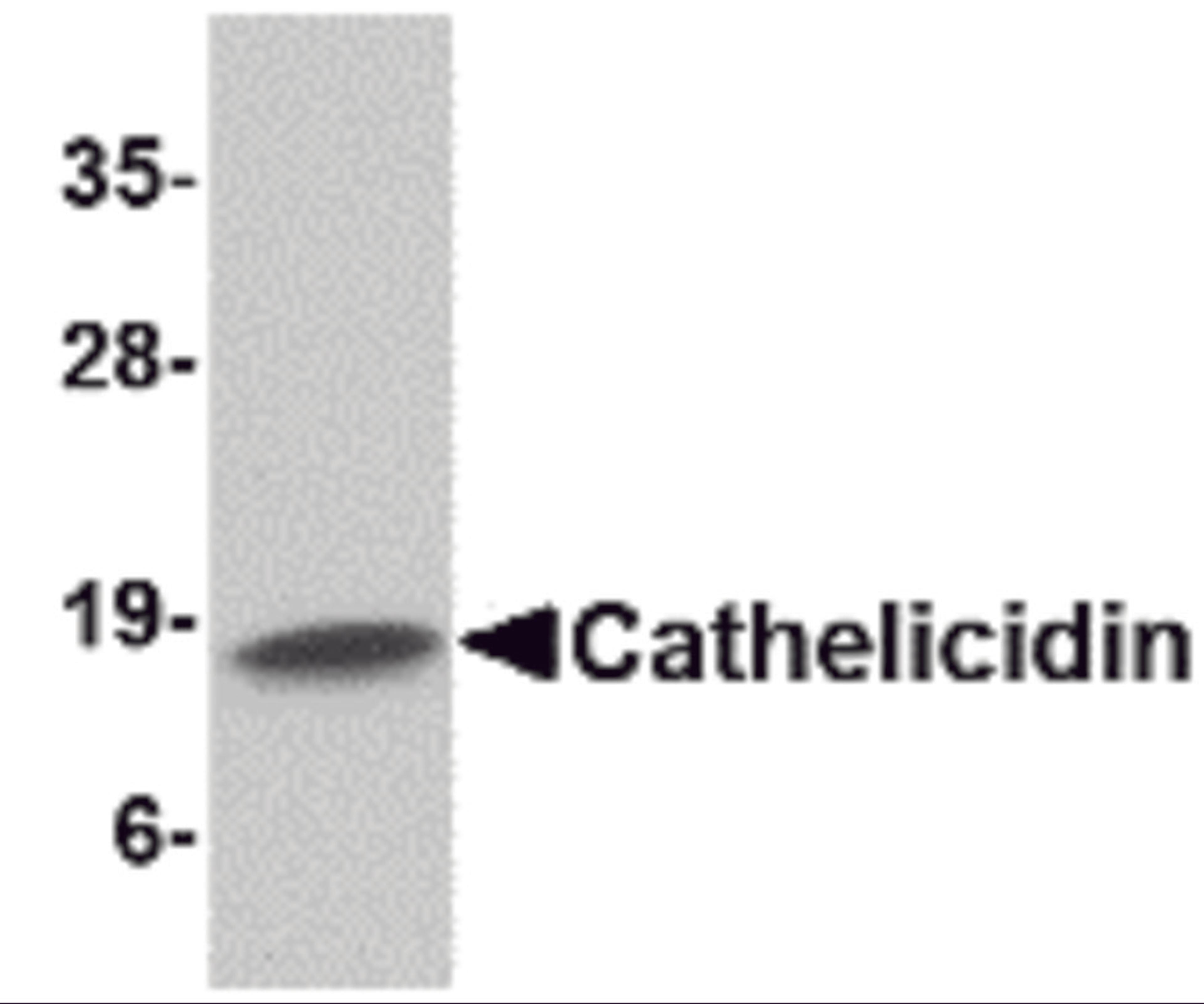 Western blot analysis of Cathelicidin in Human spleen tissue lysate with Cathelicidin antibody at 1 μg/mL.